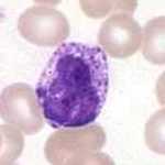 If you want to classify white blood cells, you will encounter skew. In a normal sample of blood you will find 62% neutrophils, but only 0.4% basophils. Basophils will be heavily underrepresented in your training data. Images public domain via Wikimedia Commons.